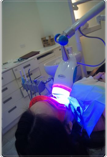 【牙醫】介紹高雄牙科診所做的牙齒冷光美白技術,牙醫分享好多資訊唷~就連價格也很公開透明唷!