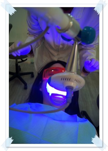 【冷光牙齒美白推薦】台北牙醫診所的牙齒冷光美白親身經驗超推薦,我的牙齒變得好白淨唷,醫師超專業又好貼心~~發光發光