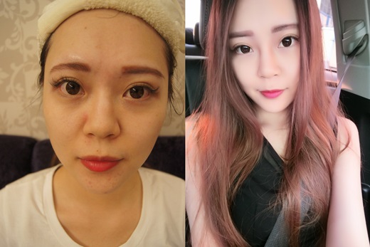 台中醫美,台中醫美推薦,醫美推薦台中,台中醫美介紹,台中醫美診所,醫美診所台中,台中玻尿酸,台中打玻尿酸,台中玻尿酸推薦,台中玻尿酸山根,台中肉毒,台中肉毒推薦,台中肉毒桿菌,台中肉毒小臉,台中醫美價格,台中醫美評價,台中醫美比較,台中公主玻尿酸,公主玻尿酸台中,台中醫美價錢,台中玻尿酸,台中玻尿酸價格,台中玻尿酸評價,台中玻尿酸介紹,台中玻尿酸分享,台中玻尿酸價錢,台中玻尿酸比較,台中玻尿酸評論,台中肉毒價格,台中肉毒評價,台中肉毒介紹,台中肉毒價錢,台中肉毒比較,台中醫美推薦,台中打玻尿酸,台中肉毒桿菌,台中醫美評價,台中玻尿酸價格 台中醫美,台中醫美推薦,醫美推薦台中,台中醫美介紹,台中醫美診所,醫美診所台中,台中玻尿酸,台中打玻尿酸,台中玻尿酸推薦,台中玻尿酸山根,台中肉毒,台中肉毒推薦,台中肉毒桿菌,台中肉毒小臉,台中醫美價格,台中醫美評價,台中醫美比較,台中公主玻尿酸,公主玻尿酸台中,台中醫美價錢,台中玻尿酸,台中玻尿酸價格,台中玻尿酸評價,台中玻尿酸介紹,台中玻尿酸分享,台中玻尿酸價錢,台中玻尿酸比較,台中玻尿酸評論,台中肉毒價格,台中肉毒評價,台中肉毒介紹,台中肉毒價錢,台中肉毒比較,台中醫美推薦,台中打玻尿酸,台中肉毒桿菌,台中醫美評價,台中玻尿酸價格